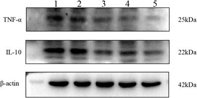 Synergistic delivery of resveratrol and ultrasmall copper-based nanoparticles by aptamer-functionalized ultrasound nanobubbles for the treatment of nonalcoholic fatty liver disease